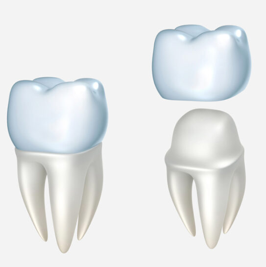 Dental Crowns