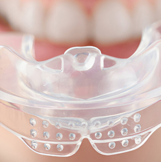 Mouthguards