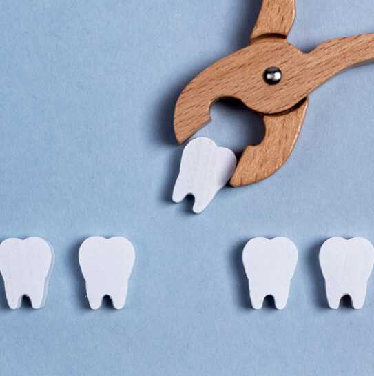 Tooth Extractions