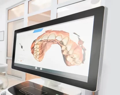 What Are the Early Signs of Oral Cancer? 